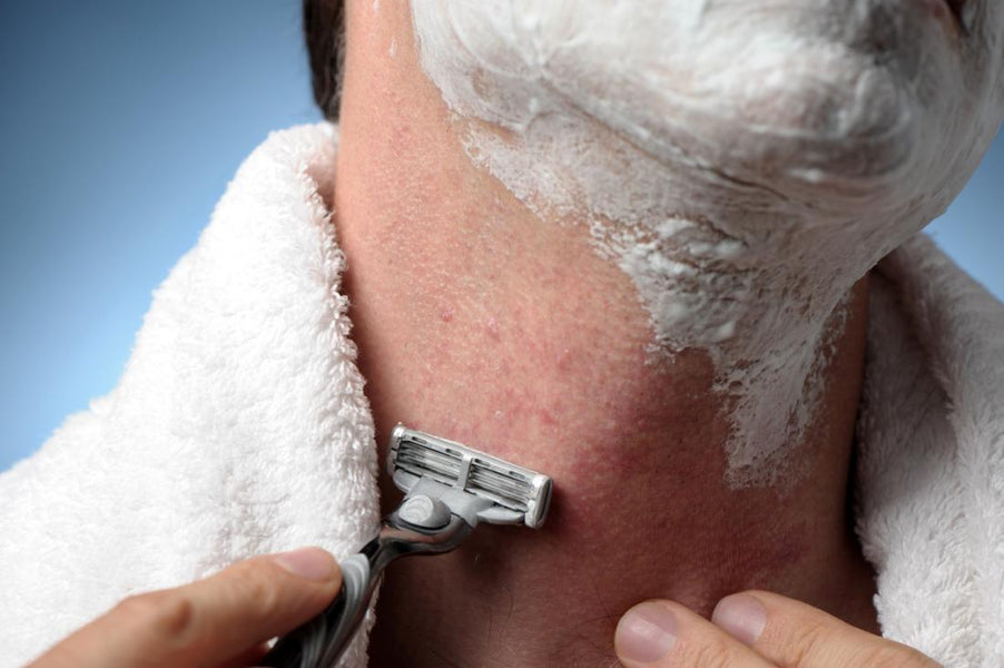 How to Prevent Razor Burn